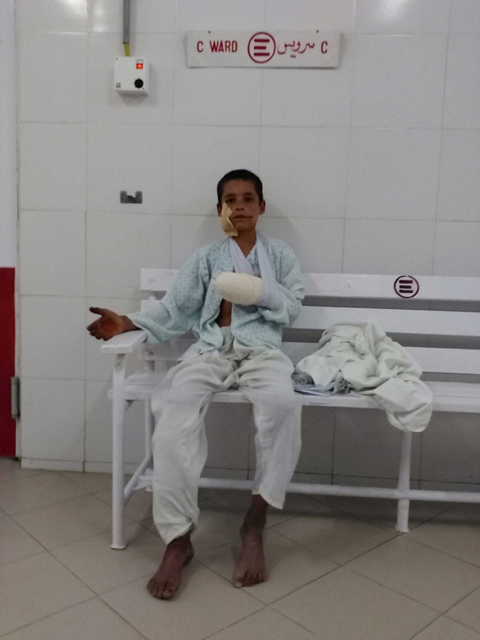 At the entrance of one of Lashkar-gah's hospital wards, a child shows his injured arm.