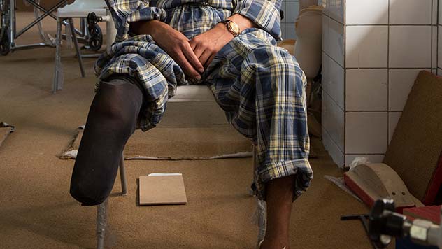 Un ragazzo senza una gamba, vittima di guerra
