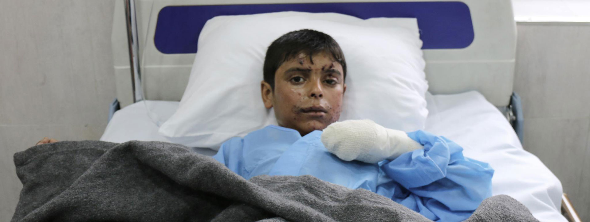 Rayid, un bambino di 10 anni ferito da una mina, nel letto dell'Emergency Hospital di Erbil, in Iraq