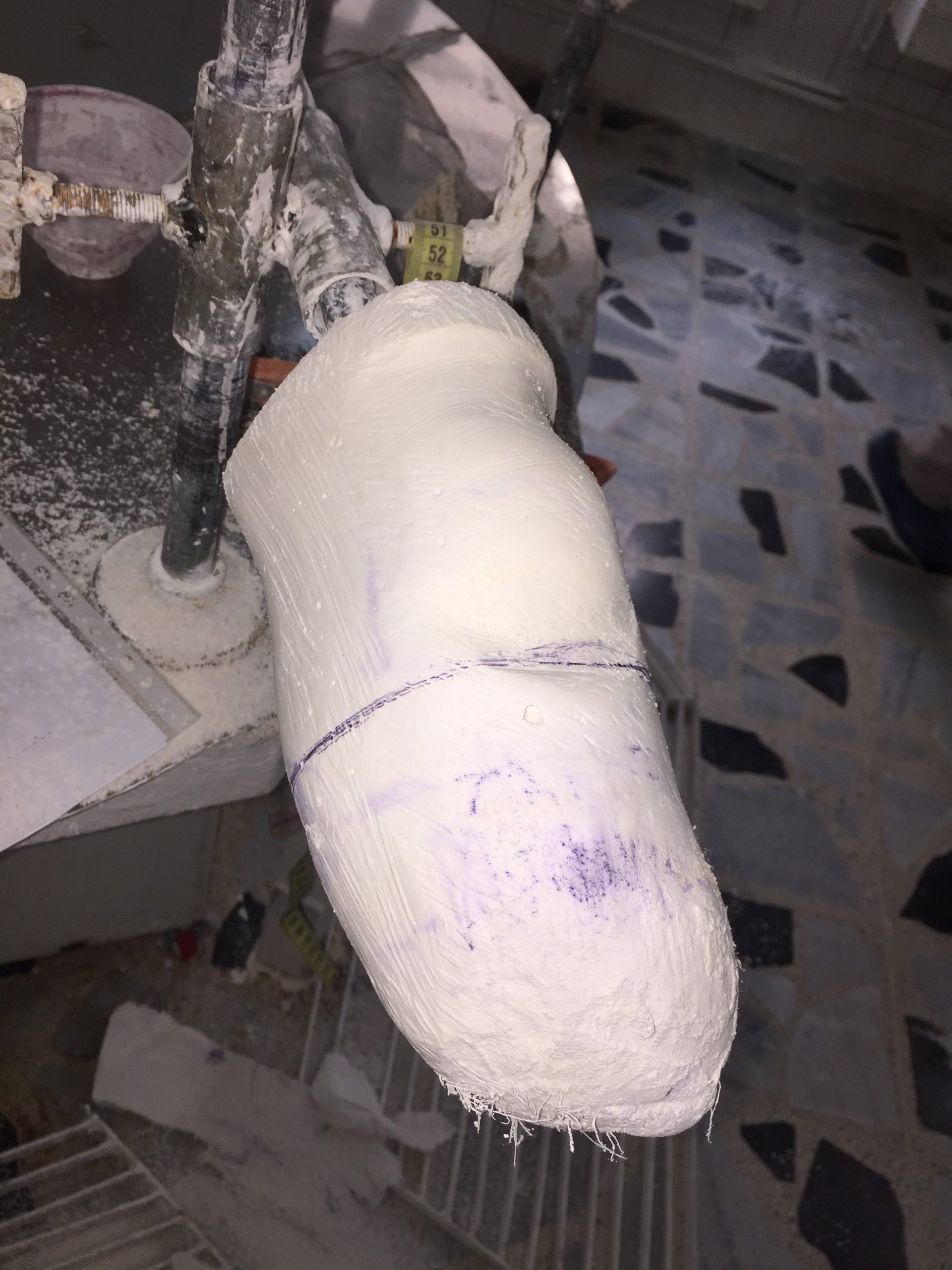 Protesi del Centro di riabilitazione di Sulaimaniya in Iraq