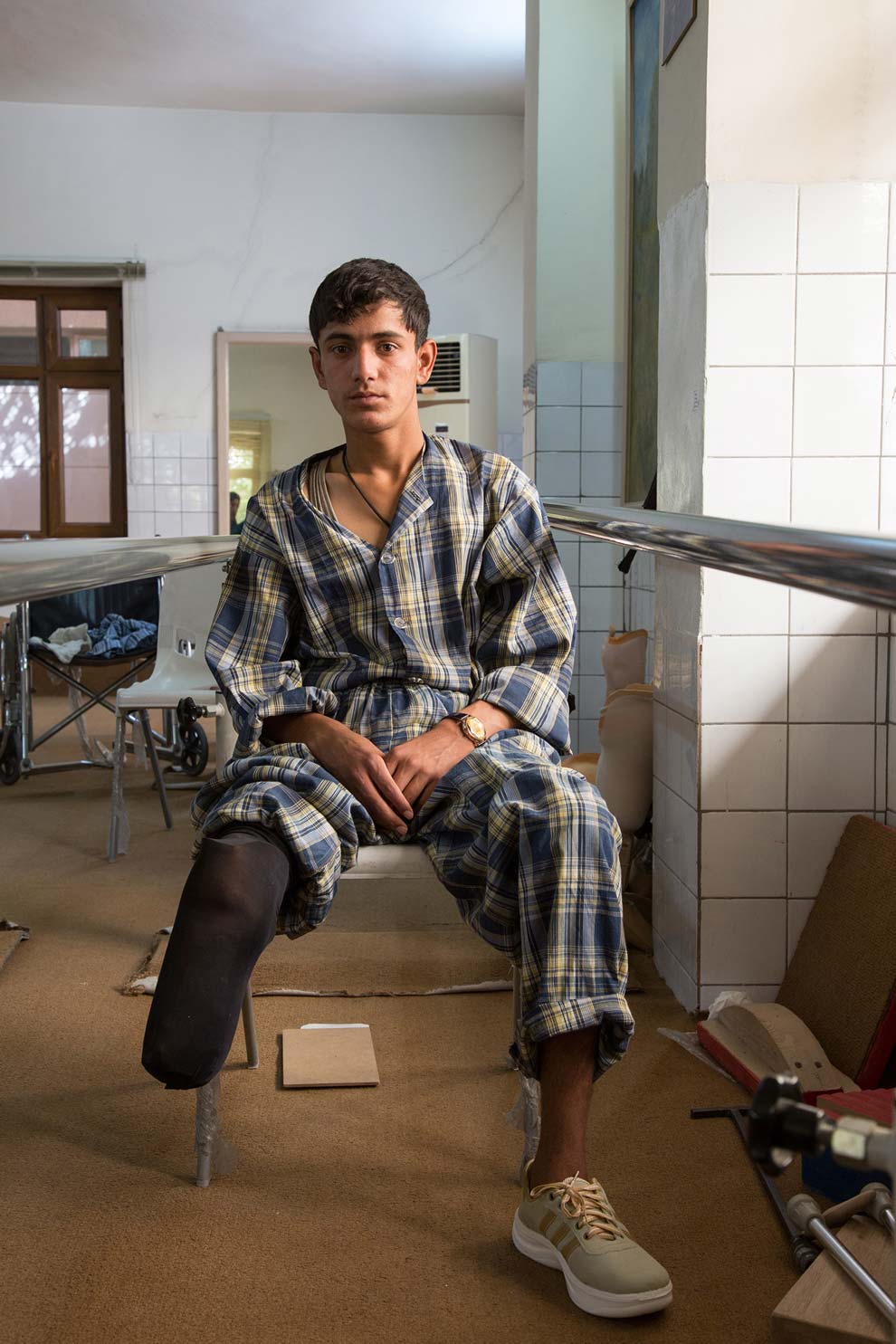 A child who lost a leg due to war